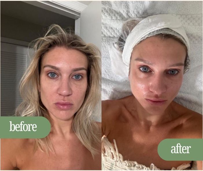 Facial before and after, client before treatment and after with a headband
