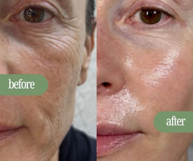 Close-up of skin before and after a treatment